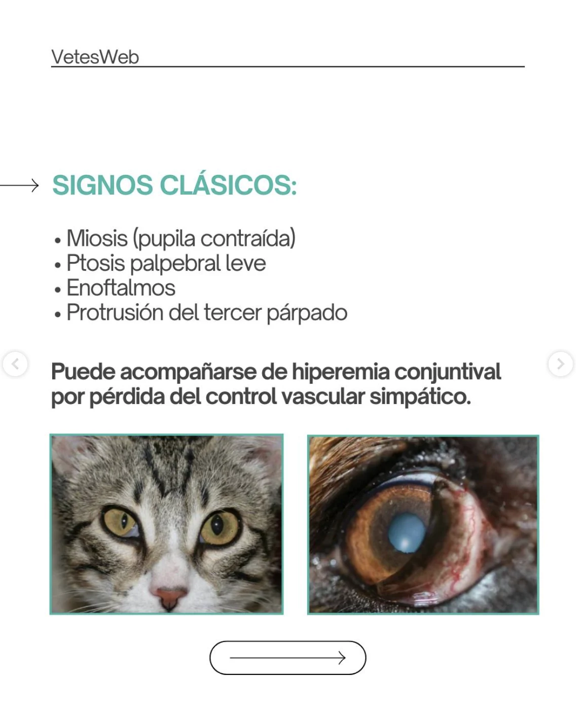 Síndrome de Horner: signos clásicos y ejemplo clínico